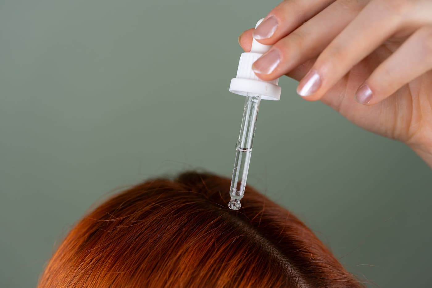 Pellicules : les causes et quoi faire
